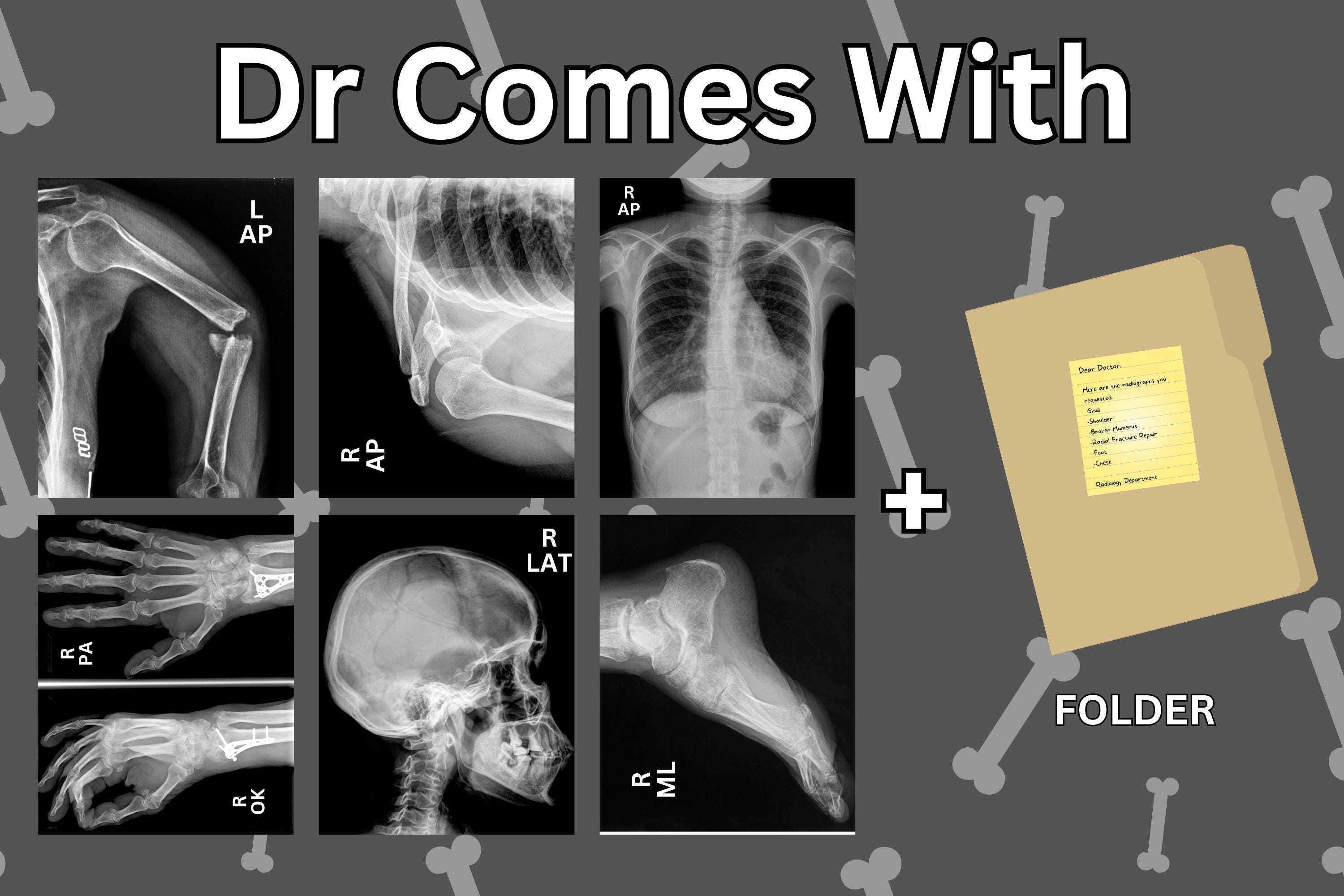 Physical Play X-rays Best Quality Pretend Radiographs for Kids Doctor ...