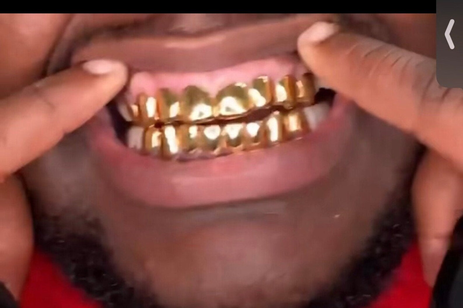 Custom Grillz single teeth Etsy