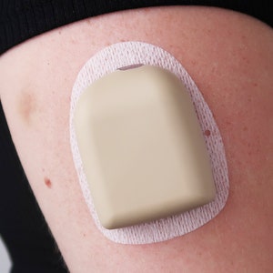 May include: A beige medical device with a white adhesive patch is attached to a person's arm.