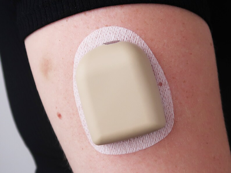 May include: A beige medical device with a white adhesive patch is attached to a person's arm.