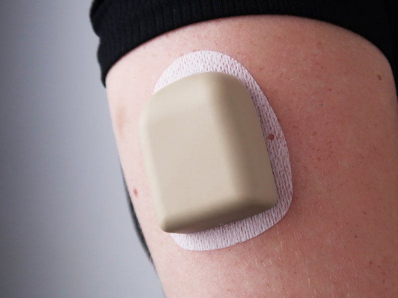 May include: A beige medical device with a white adhesive backing is attached to a person's arm.