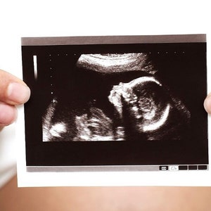 Cute Ways to Use Ultrasound Pictures - Peppy Prints