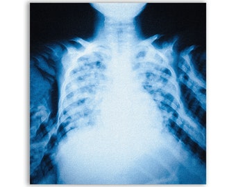 X-ray Rib Cage Patch