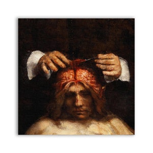 May include: A painting depicting a surgical procedure, with a person's exposed brain visible. The brain is red and fleshy, and the surgeon's hands are visible holding surgical tools.
