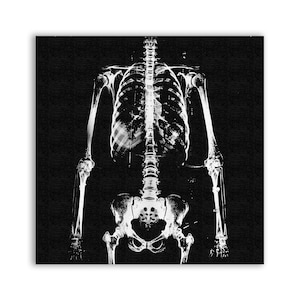 Puede incluir: Una imagen de rayos X en blanco y negro de un esqueleto humano. El esqueleto está de frente con los brazos a los lados. La imagen muestra los huesos de la caja torácica, la columna vertebral, la pelvis y las extremidades.