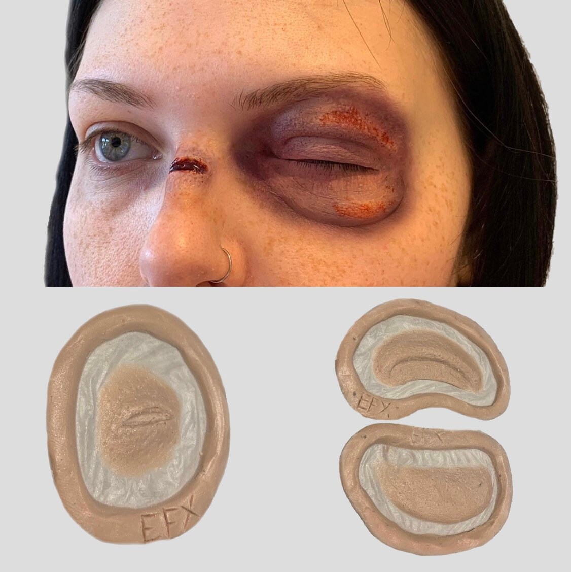 Beaten up Encapsulated Prosthetics Swollen Eye Broken Nose - Etsy