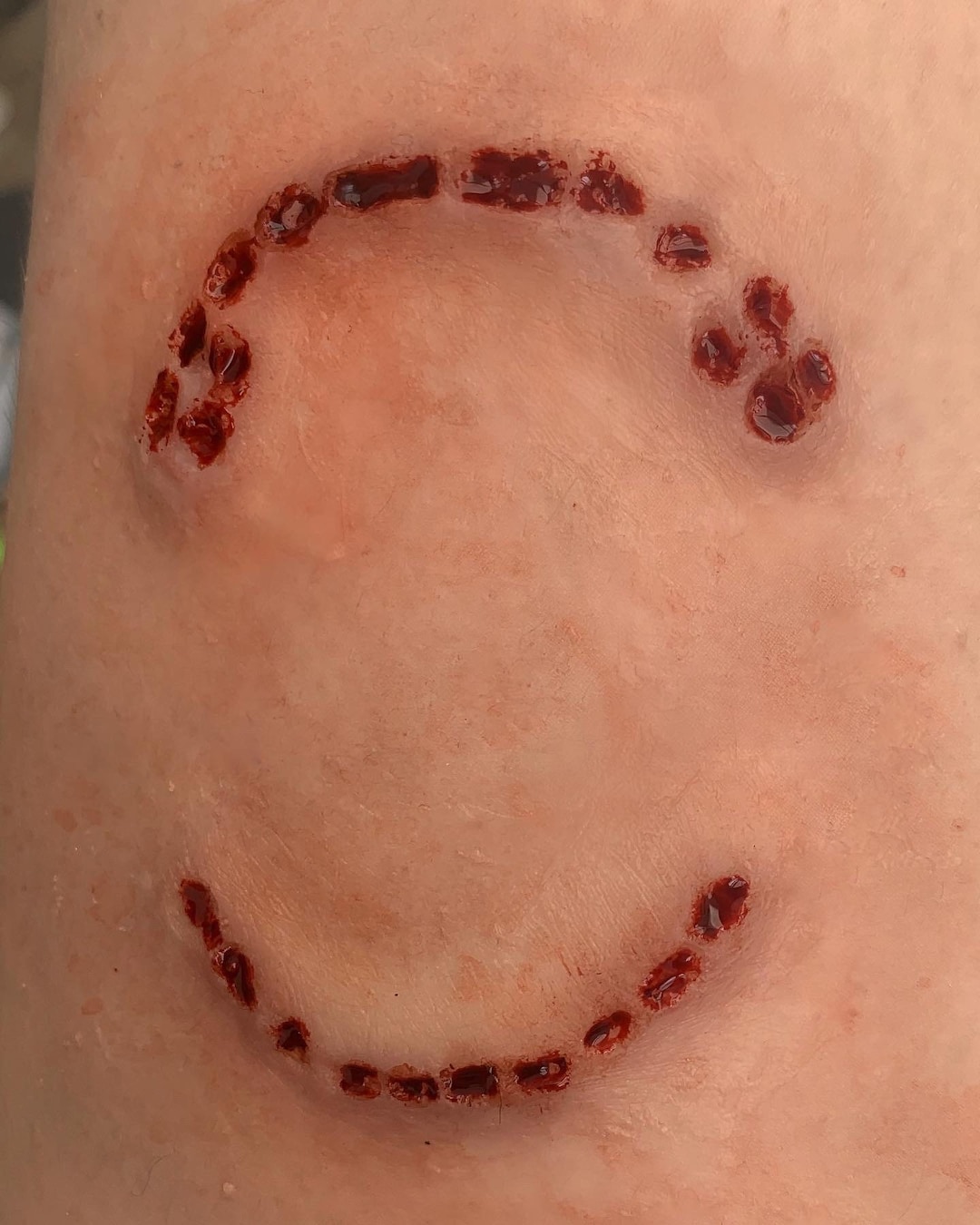 Silicone Prosthetic Bite Mark, SFX, Makeup, Horror, Blood, Zombie