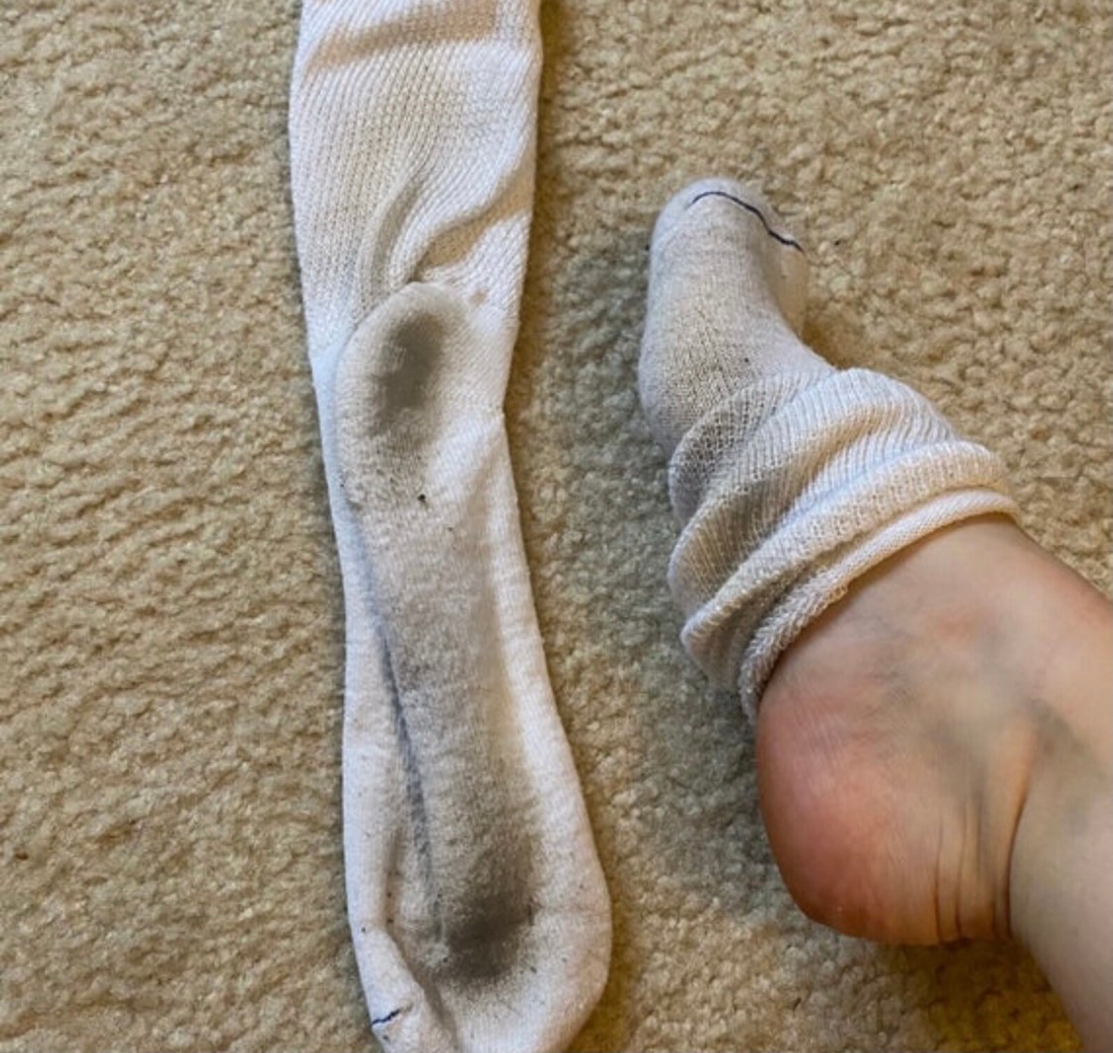 Well worn used compression socks Etsy