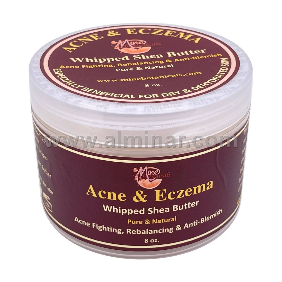 Acne & Eczema Whipped Shea Butter 8oz by Mine Botanicals Etsy