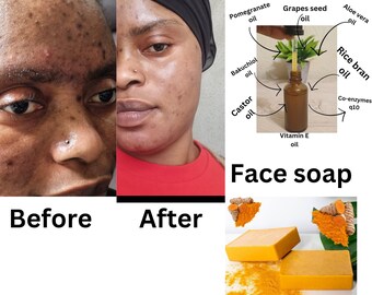 Huile pour le visage éclaircissante curcuma+grenade+aloès avec savon pour le visage au curcuma, huile pour le visage au bakuchiol, huile pour le visage aux coenzymes Q10, 100 % naturelle !