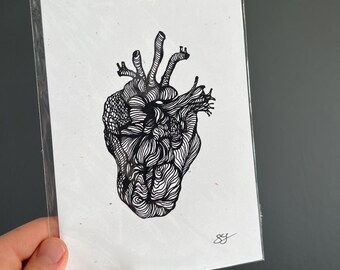 massive- art print