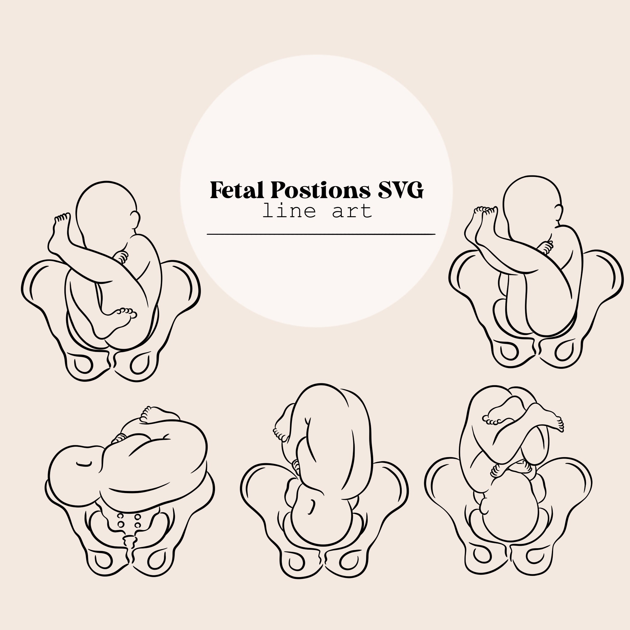 What Is Fetal Outline