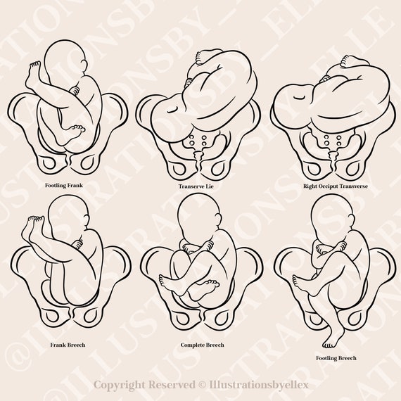 Girl In Fetal Position Drawing