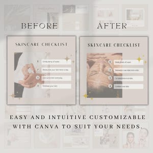 May include: A skincare checklist graphic with "BEFORE" and "AFTER" comparisons. The checklist includes steps like drinking water, moisturizing, using sunscreen, and exfoliating. The text "EASY AND INTUITIVE CUSTOMIZABLE WITH CANVA TO SUIT YOUR NEEDS" is also present.