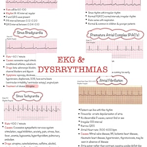 Basic EKG Dysrhythmias & Interpretation | Nursing Notes 6 PAGES | Digital Download PDF