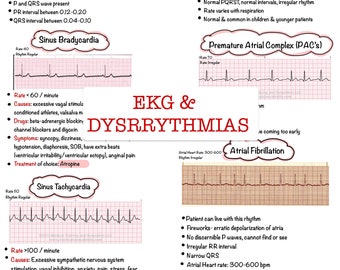 Basic EKG Dysrhythmias & Interpretation | Nursing Notes 6 PAGES | Digital Download PDF