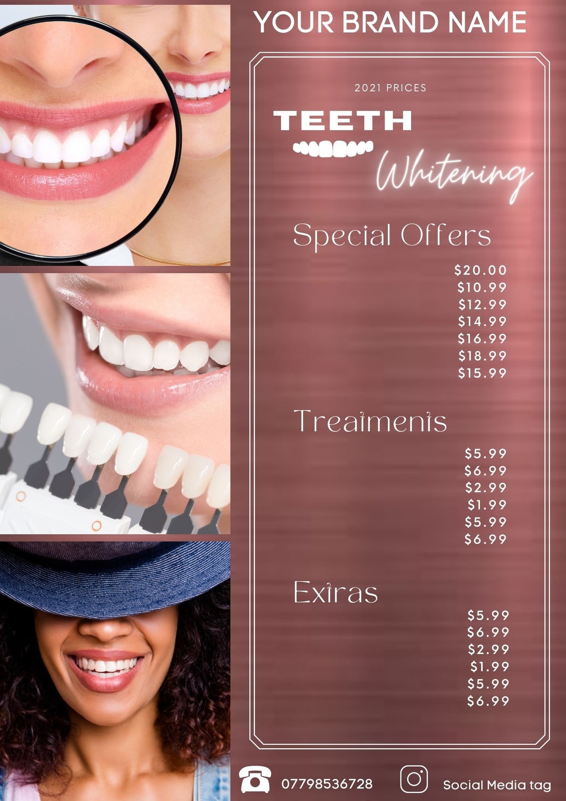 Teeth Whitening Branding Instagram Flyer posts Premade DIY Etsy