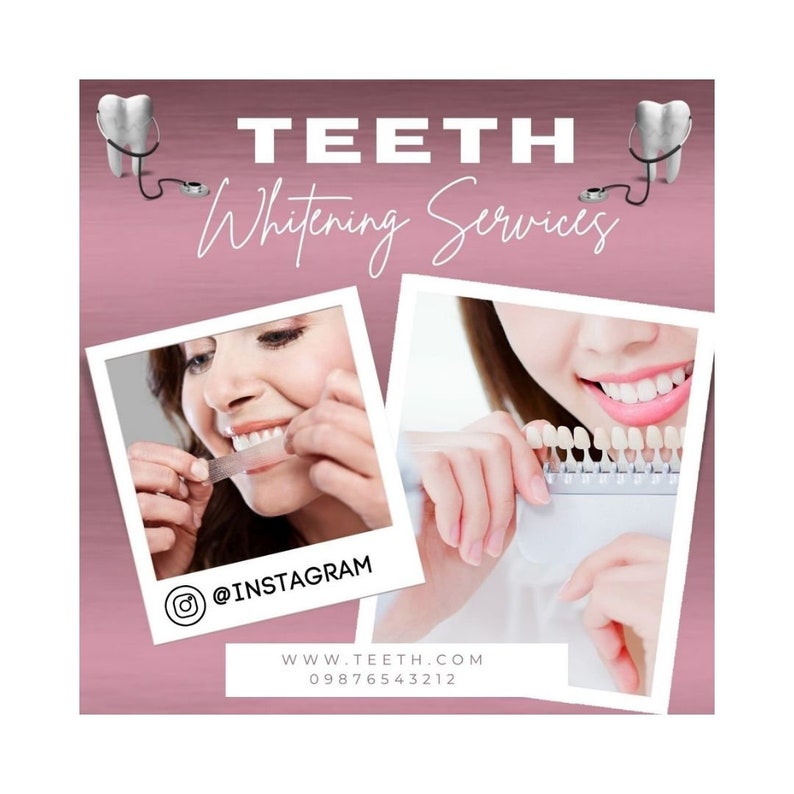 Teeth Whitening Flyer Animated Teeth Whitening Posts Teeth Whitening Branding Teeth Whitening