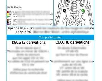 ECG memo sheet for nurse