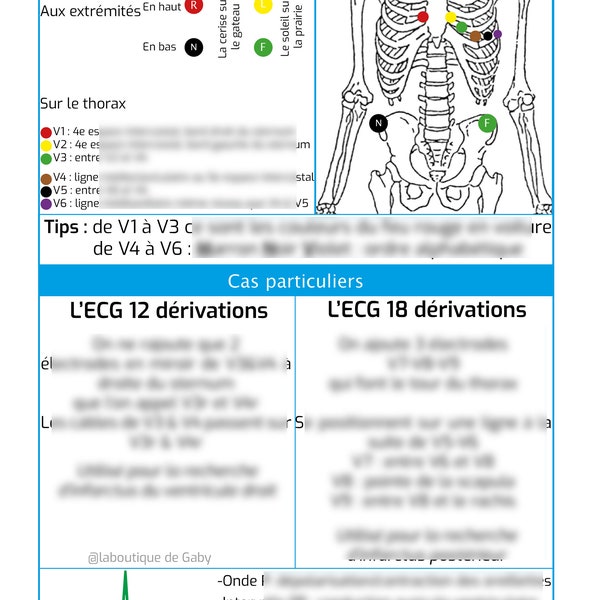 Fiche mémo ECG pour infirmière