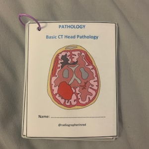Puede incluir: Una ilustración en blanco y negro de una sección transversal de una cabeza humana con varias áreas coloreadas que representan diferentes partes del cerebro. El título "PATHOLOGY Basic CT Head Pathology" está en la parte superior de la imagen. El texto "Name: @radiographerinnred" está en la parte inferior de la imagen.