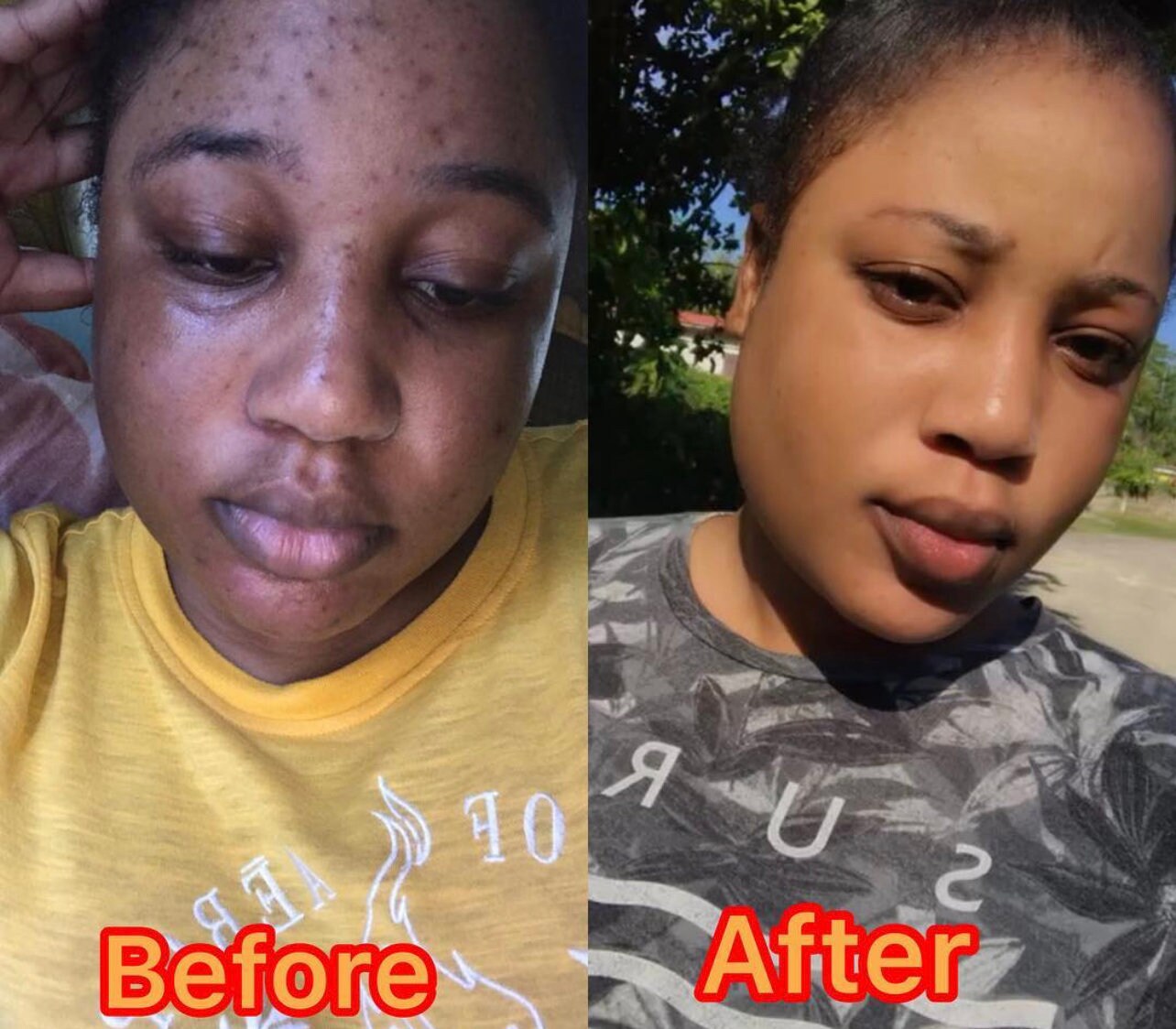 Strong Skin Lightening Cream. Effective Results in 5 days Etsy