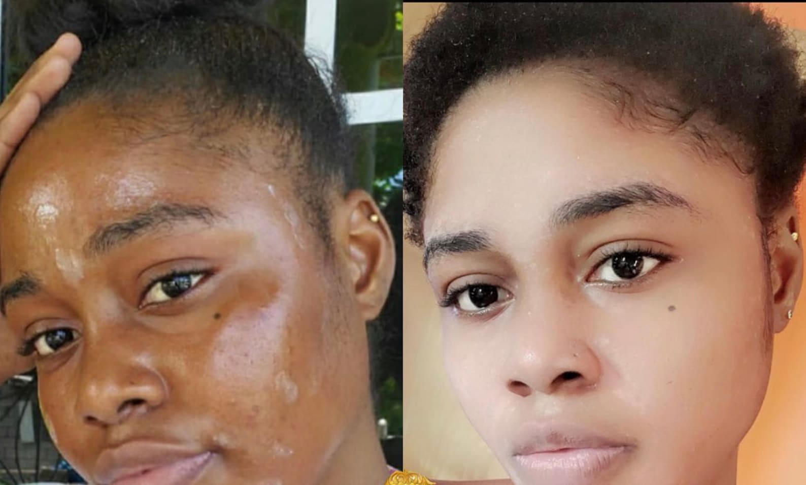 Strong Skin Lightening Cream. Effective Results in 5 days Etsy