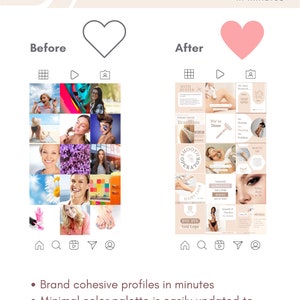 IPL Hair Removal Instagram Posts Ig Stories 80 IPL Instagram Templates ...