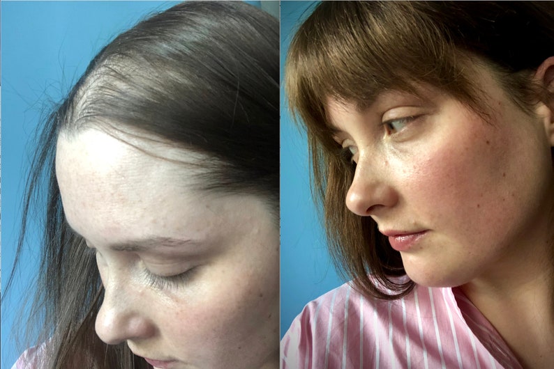 Remy Human Hair Topper Without Clips Etsy