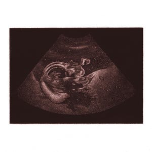 Art personnalisé de l'échographie ou de l'échographie | Souvenir de grossesse, art pour bébé héritage, décoration de chambre d'enfant, art scanné pour bébé
