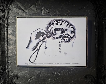 vintage lobotomy poster wall plaque