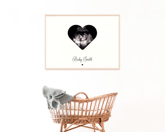 Personalized Baby Scan Print, Baby Shower Decor, Pregnancy Announcement,  Ultrasound Print, Gift For Grandparents, Baby Due Date Print