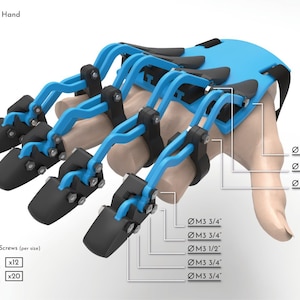 Prosthetic fingers - 3D PRINT PROSTHETIC FINGER, Stl File diy, print your own prosthetic hand