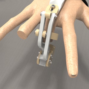 Complete Prosthetic Hand: Individual STL Files for Thumb, Index, Middle, Ring, and Pinky Fingers, 3D Print Your Custom Prosthetic Hand