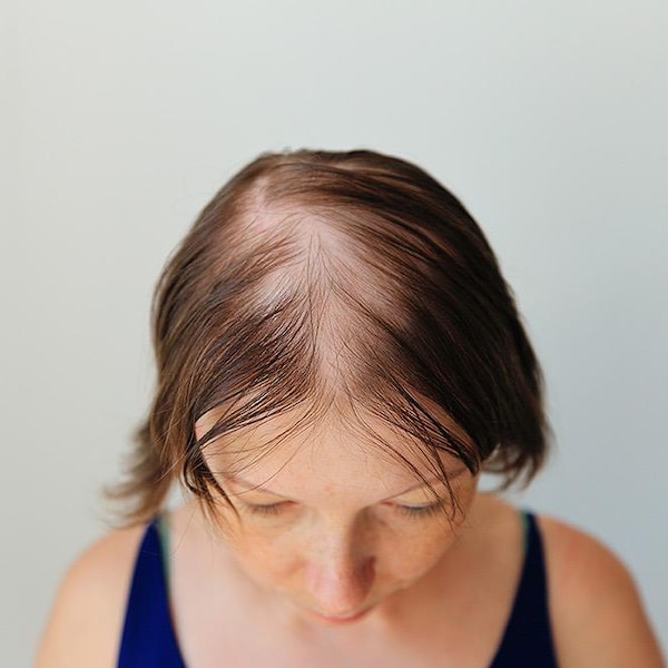 Hair Growth Spell: Personalized Ritual for Hair Loss