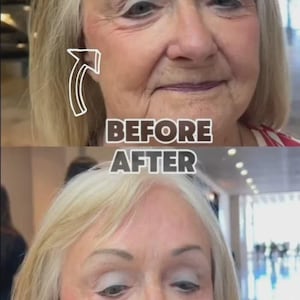 Stronger than SERIOUS SKINCARE Insta-Tox Facial Tightening Serum and P derm RapidReductionSerum in  a Concentrated  4.5 oz