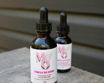 Olejek botaniczny do twarzy Pimple Be Gone | Naturalny olejek do twarzy do skóry z niedoskonałościami | Lekka pielęgnacja na bazie roślin