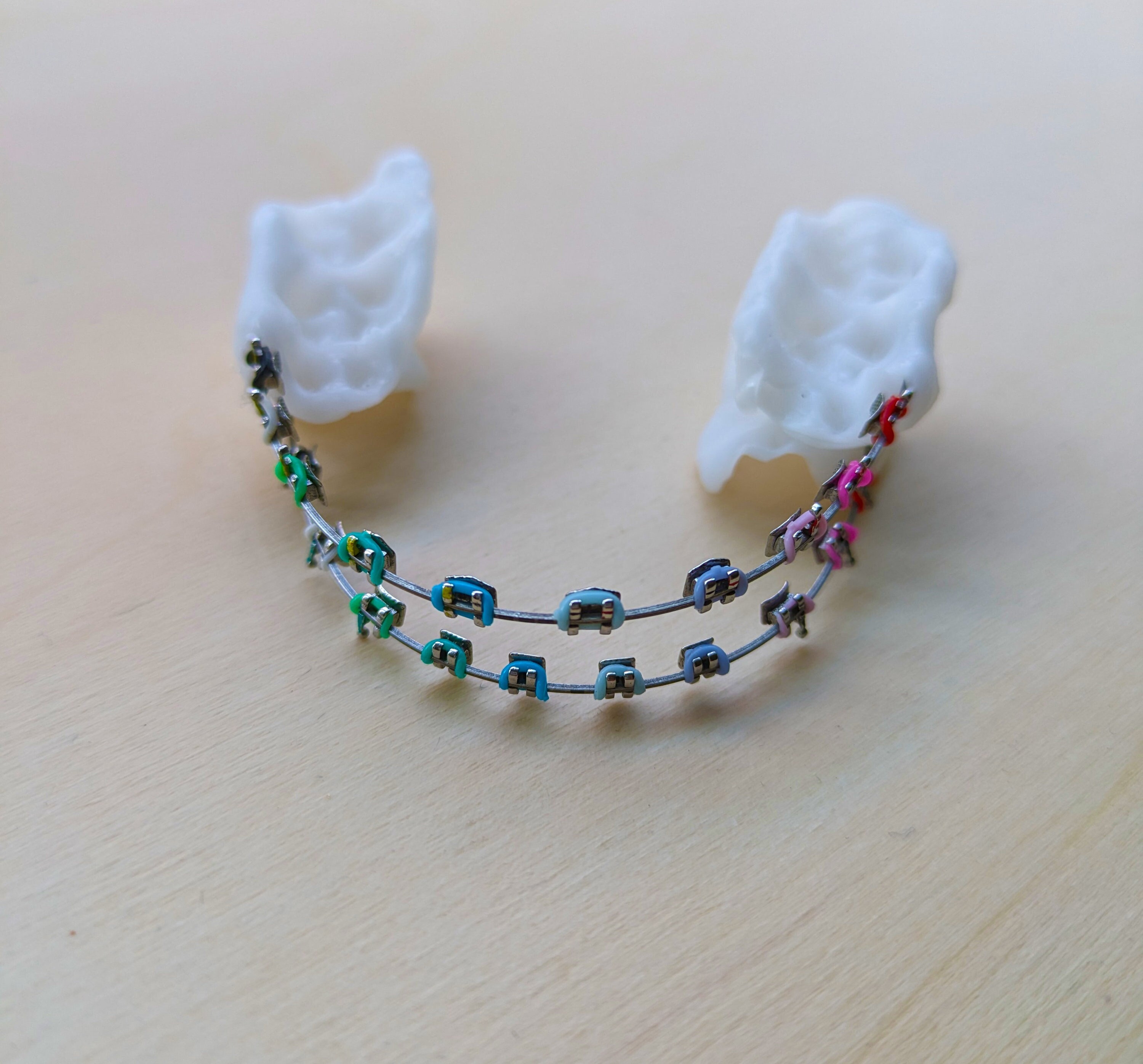 Braces Type I - Cosplay DIY Kit - Etsy