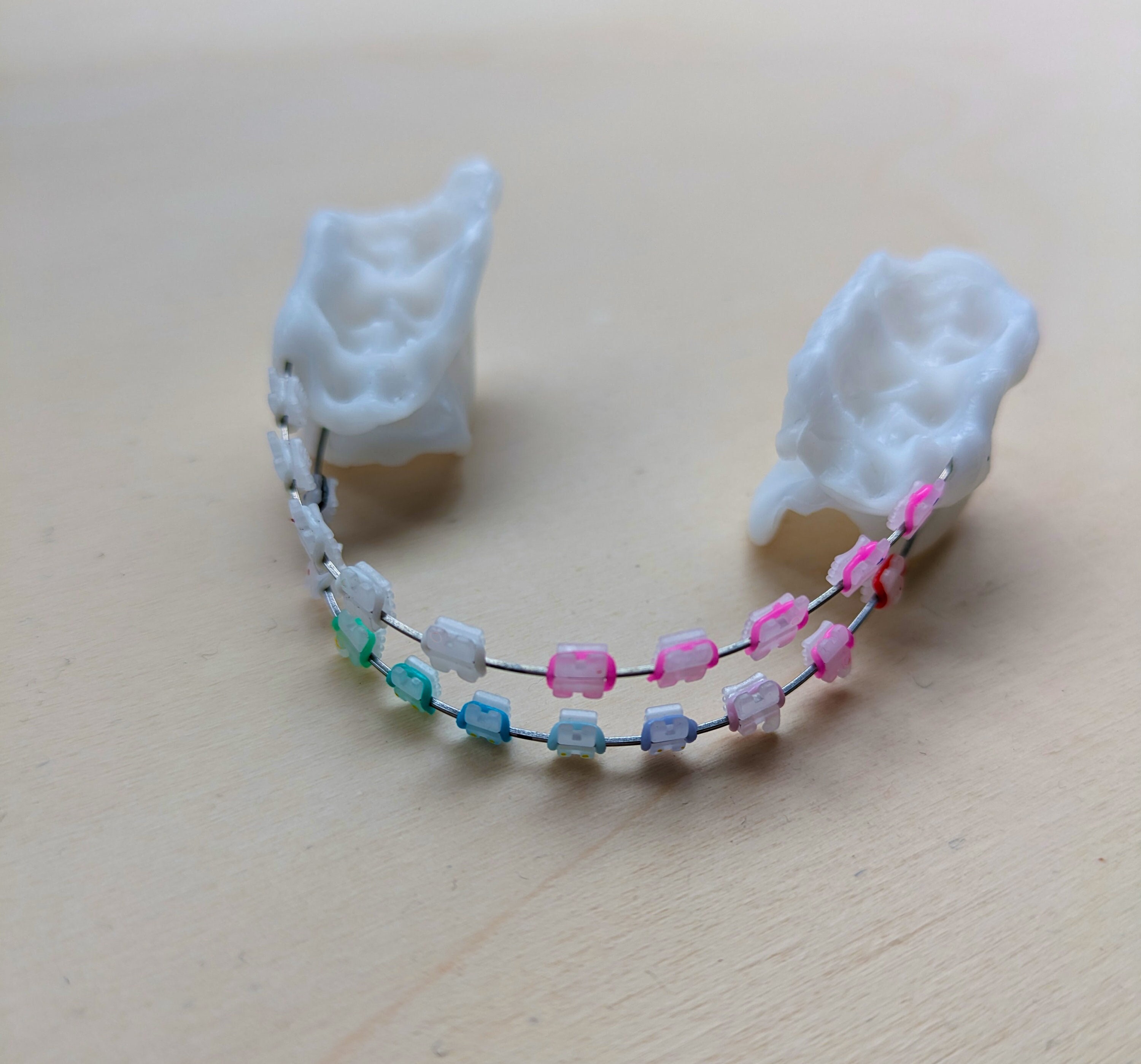 Ceramic Braces - Cosplay DIY Kit - Etsy