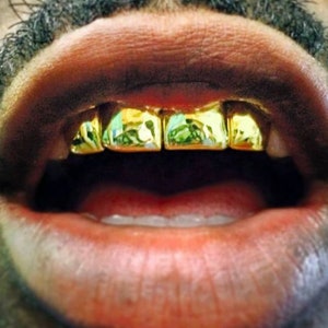 4 teeth solid 18k gold permanent singles gold tooth grillz