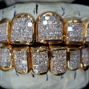 14k gold Top and bottom Grillz invisible handset