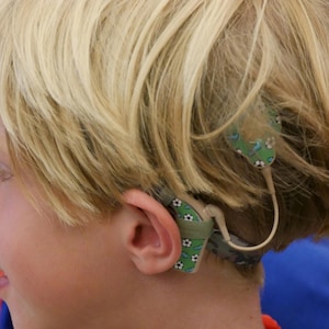 Soccer Cochlear Nucleus 7 or 8 Skins Stickers Cochlear Implant Decals HearSkins