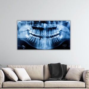 Arte de pared con rayos X de dientes, póster de rayos X de dientes, decoración de pared para sala de dentistas, decoración de pared para consultorio dental, arte de impresión de rayos X de dientes, lienzo de rayos X de dientes