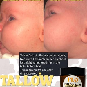 Op de afbeelding: Vergelijking van een babywang voor en na gebruik van Tallow Balm. De "Voor" foto toont uitslag, de "Na" foto toont een vermindering. Een pot Tallow Balm is ook zichtbaar, met informatie over de ingredi&euml;nten.