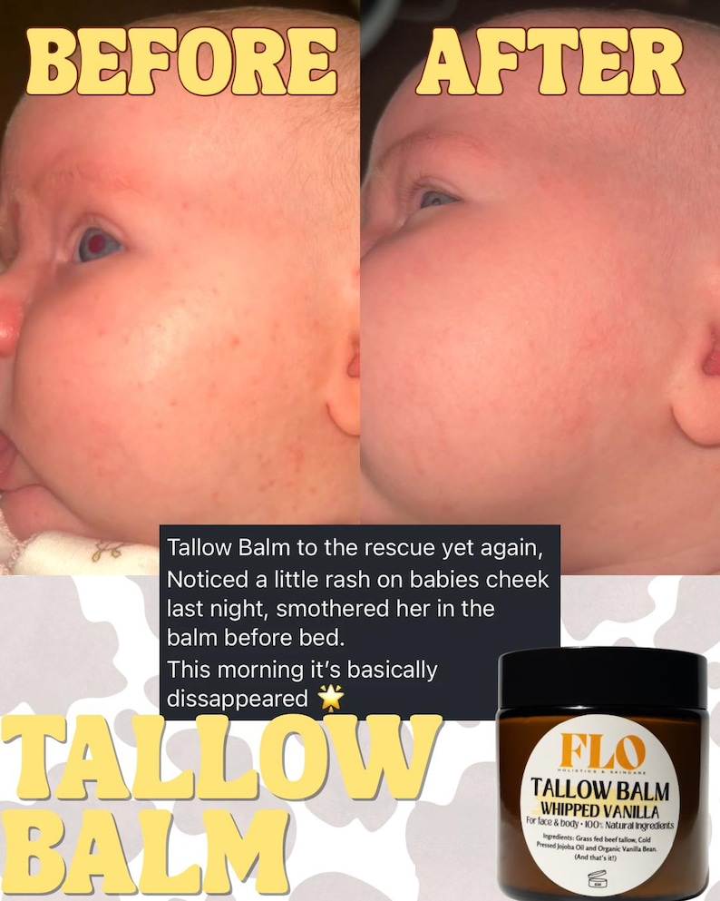 Op de afbeelding: Vergelijking van een babywang voor en na gebruik van Tallow Balm. De "Voor" foto toont uitslag, de "Na" foto toont een vermindering. Een pot Tallow Balm is ook zichtbaar, met informatie over de ingredi&euml;nten.