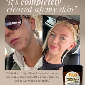 Tallow Balm - Whipped Vanilla – Natural Moisturiser for Dry & Sensitive Skin, Beef Tallow Skincare, Handmade Body Butter afbeelding 2