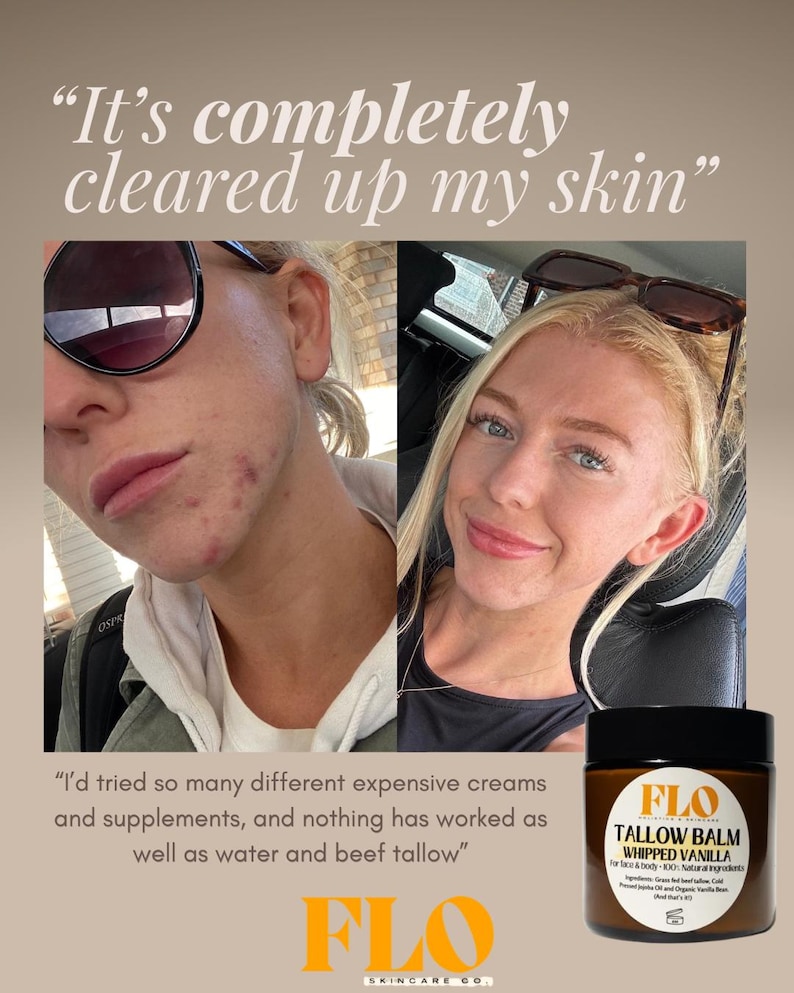 Tallow Balm - Whipped Vanilla – Natural Moisturiser for Dry & Sensitive Skin, Beef Tallow Skincare, Handmade Body Butter afbeelding 2