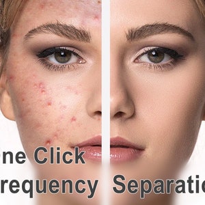 Puede incluir: Imagen de antes y después que muestra los resultados de una técnica de separación de frecuencia con un solo clic. El lado izquierdo muestra la cara de una persona con acné, mientras que el lado derecho muestra la misma cara con piel clara.