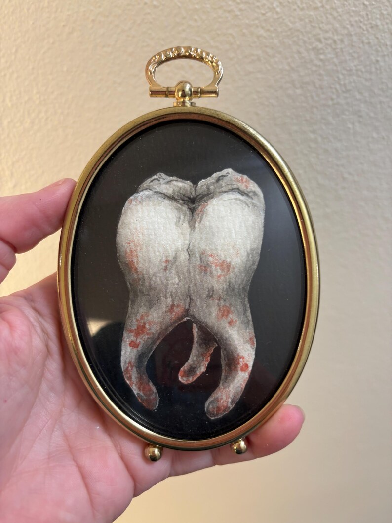 Rotten Tooth Watercolor Painting: Vintage Brass Oval Frame, Oddities ...
