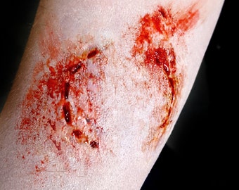 FX Human bite prosthesis - silicone